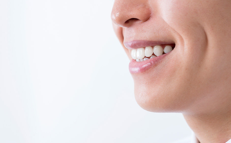 ホワイトニング